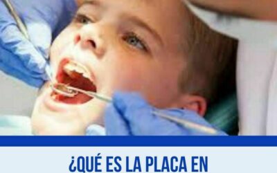 ¿Qué es la Placa en nuestros dientes?
